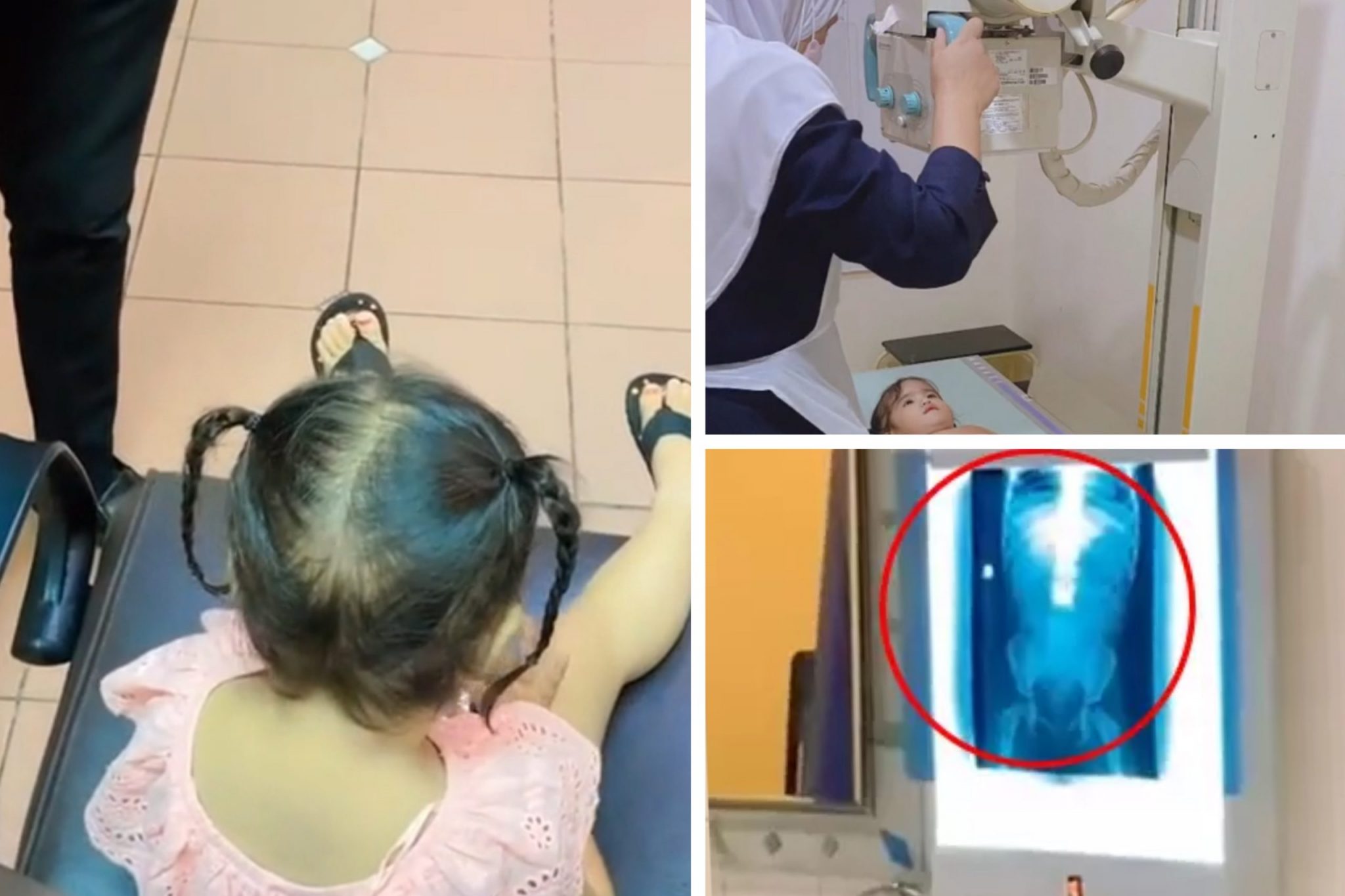 video-anak-tertel4n-syiling-10-sen-s4ngkut-dalam-badan-ibu-luah-rasa-kes4l_619a281403702-2048x1365